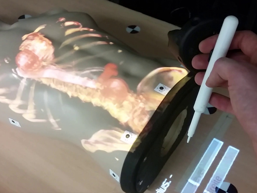Research project “MedProjection”
